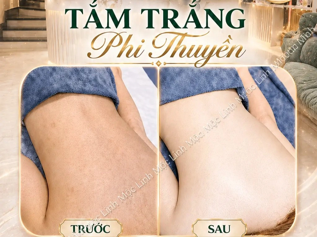 Tắm trắng phi thuyền Hải Phòng
