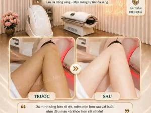 Tắm trắng phi thuyền Hải Phòng