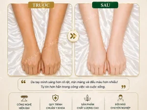 Tắm trắng phi thuyền Hải Phòng