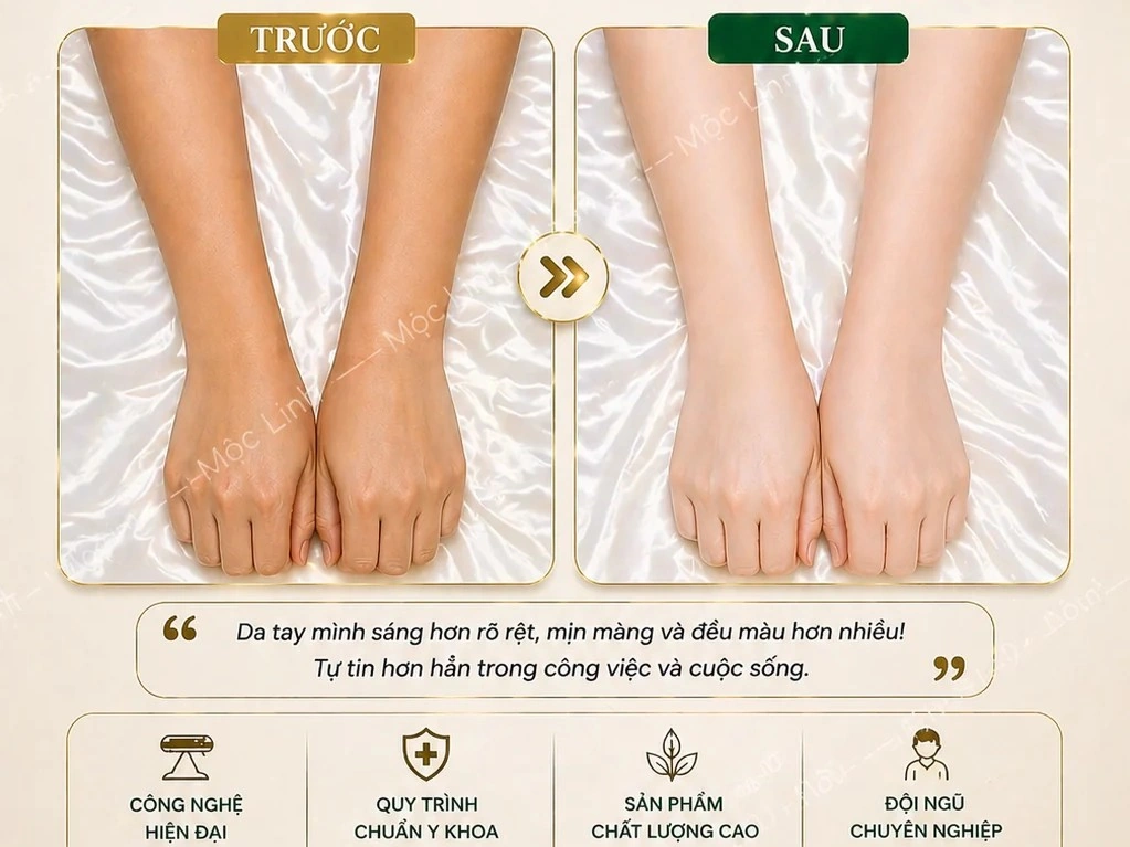 Tắm trắng phi thuyền Hải Phòng