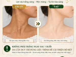 Tắm trắng phi thuyền Hải Phòng