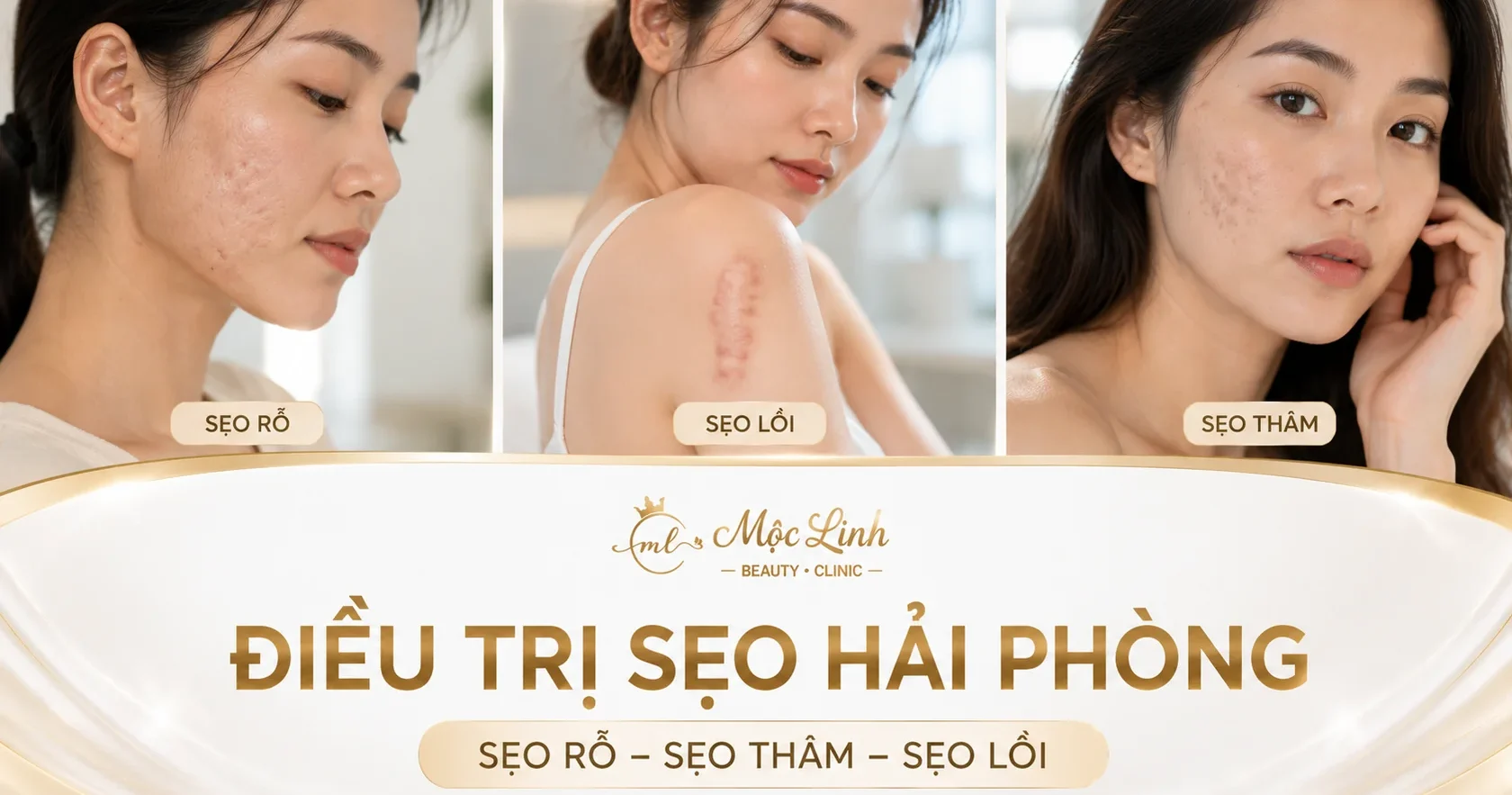 Trị Sẹo