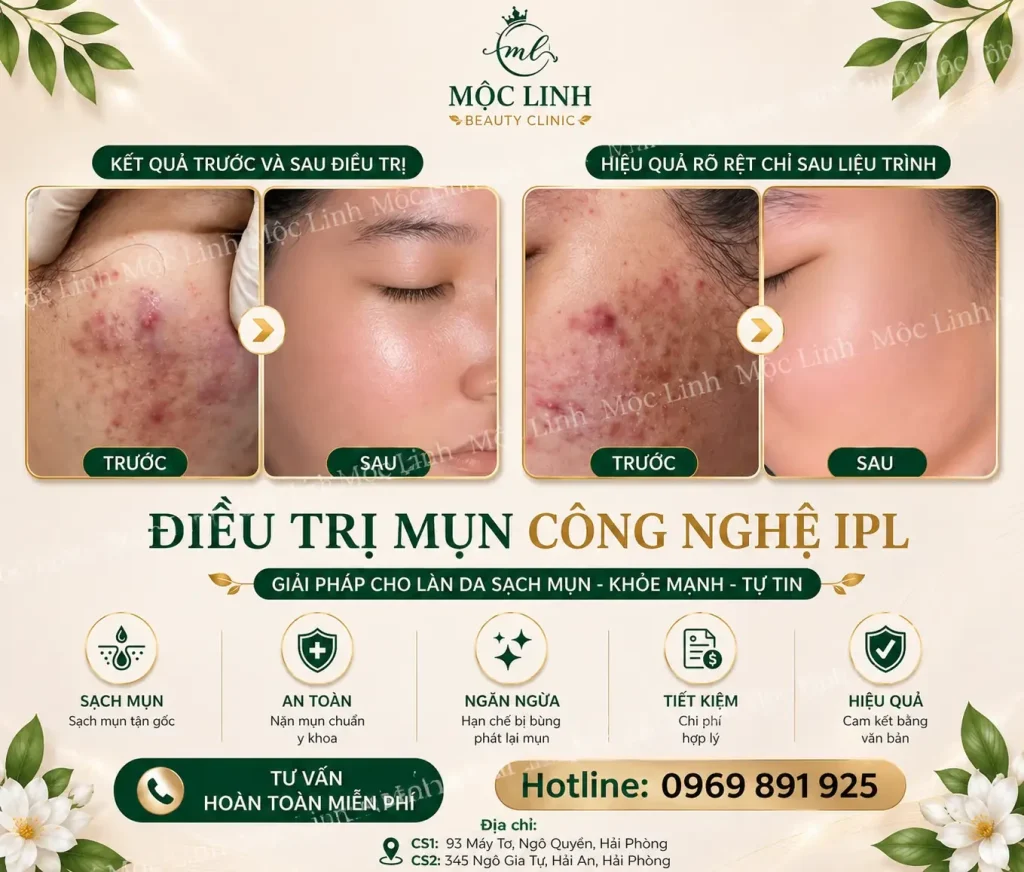 Trị Mụn Số 1 Hải Phòng
