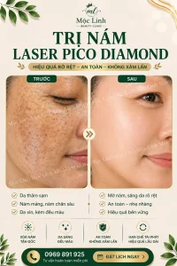 Trị nám/tàn nhang uy tín tại Hải Phòng