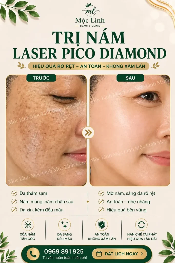 Trị nám/tàn nhang uy tín tại Hải Phòng