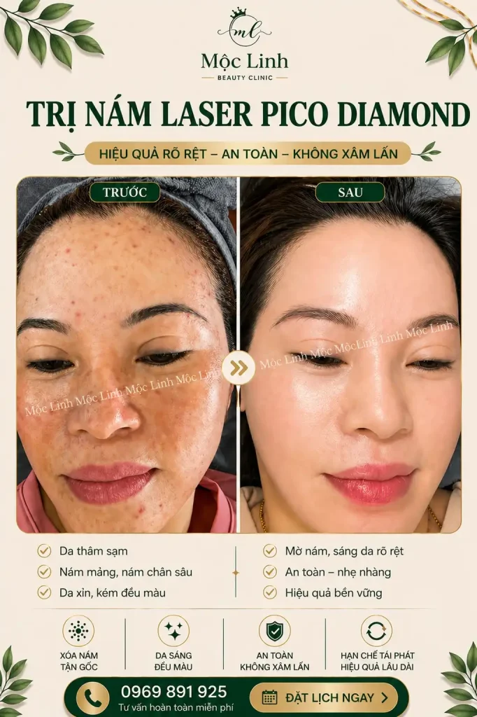 Trị nám/tàn nhang uy tín tại Hải Phòng