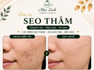 Điều trị các loại sẹo uy tín Hải Phòng