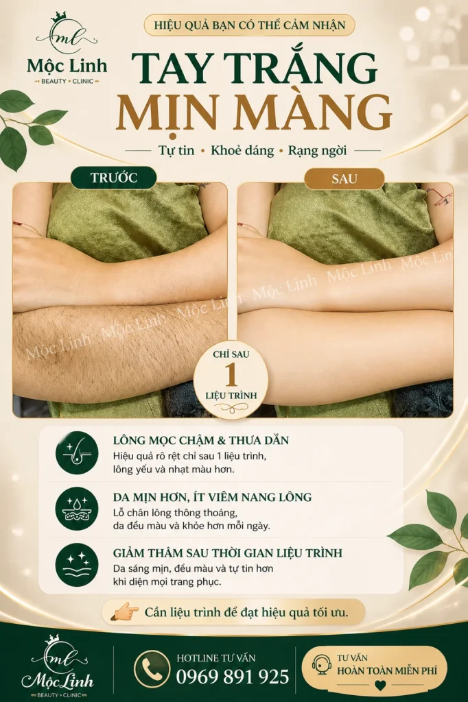 Triệt Lông Hải Phòng
