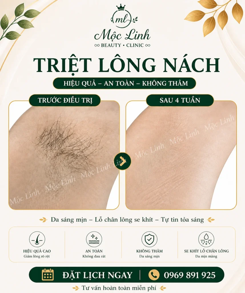 Triệt Lông Hải Phòng