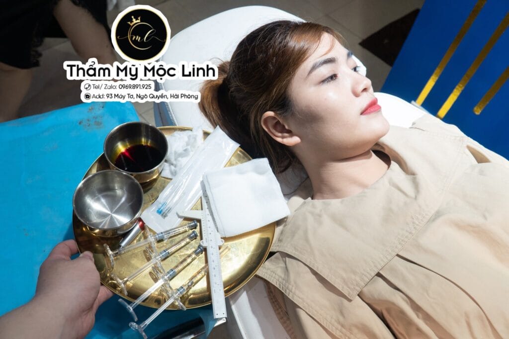 Tiêm cằm