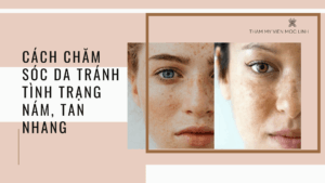 Cách chăm sóc da tránh tình trạng nám, tan nhang
