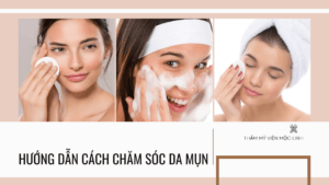 Hướng dẫn cách chăm sóc da mụn