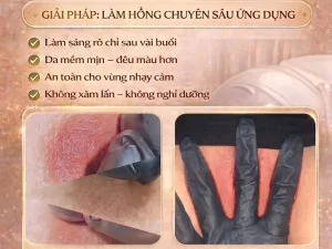Làm hồng nhũ hoa – vùng kín tại Hải Phòng