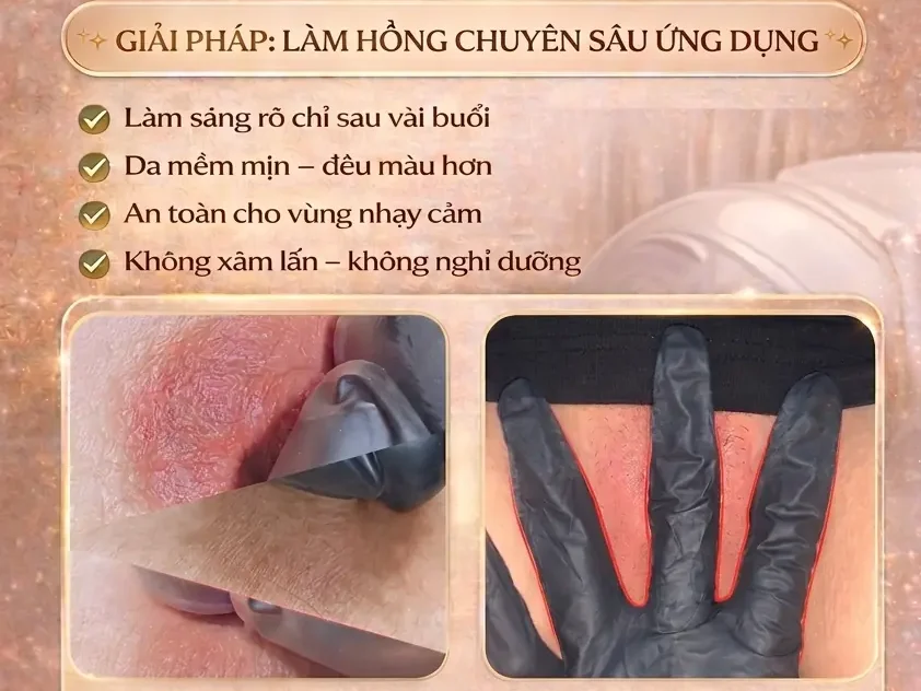 Làm hồng nhũ hoa – vùng kín tại Hải Phòng