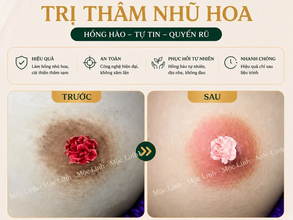 Làm hồng nhũ hoa – vùng kín tại Hải Phòng
