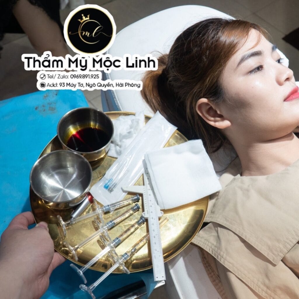 Tiêm Filler An Toàn Uy Tín Hải Phòng