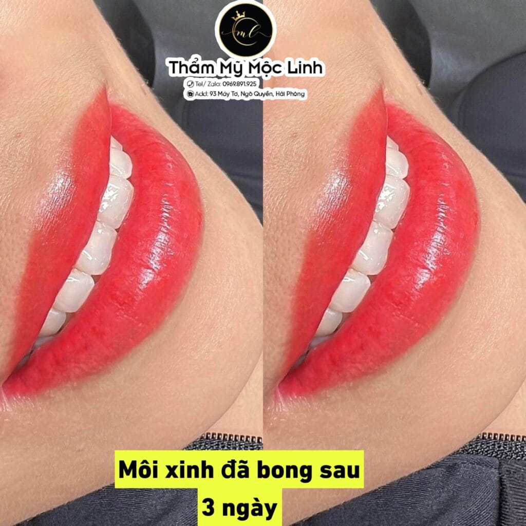 Đào tạo phun xăm thẩm mỹ cơ bản – nâng cao Thẩm Mỹ Viện Mộc Linh