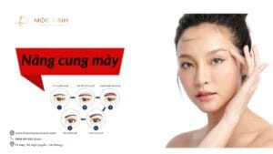 Nâng cung mày