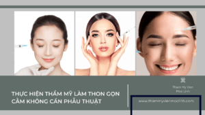 thon gọn cằm không cần phẫu thuật