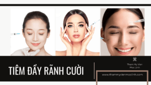 tiêm đầy rãnh cười tmvml