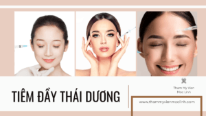 tiêm đầy thái dương tmvml