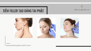 tiêm filler dáng tai phật tmvml