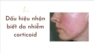 dấu hiệu nhận biết nhiễm