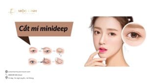 Cắt mí minideep