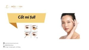 Cắt mí full