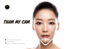 Thẩm mỹ cằm