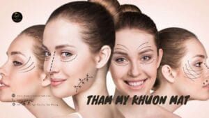 Thẩm mỹ khuôn mặt