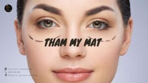 Thẩm mỹ mắt