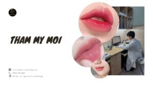 Thẩm mỹ môi