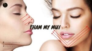 Thẩm mỹ mũi