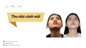 Thu nhỏ cánh mũi