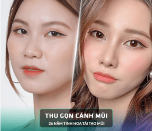 Thu nhỏ cánh mũi
