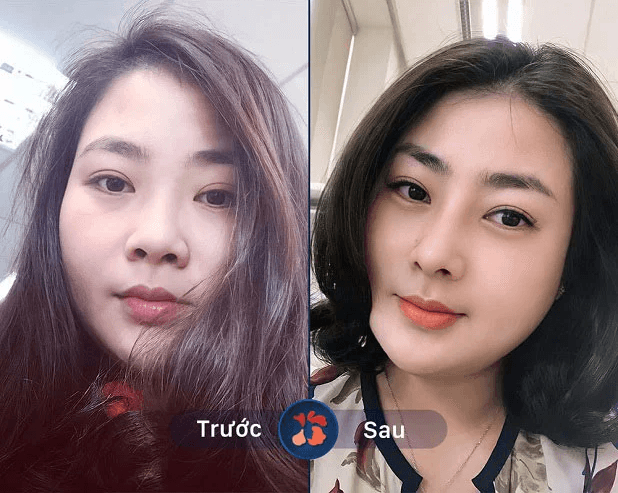 Thu nhỏ cánh mũi