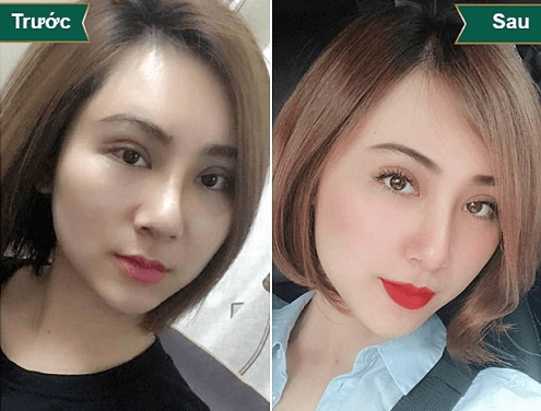 Thu Nhỏ Đầu Mũi