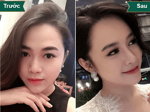 Thu Nhỏ Đầu Mũi