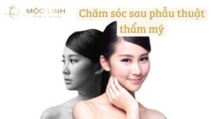 Chăm sóc sau phẫu thuật thẩm mỹ