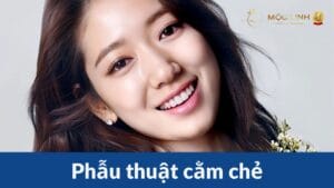 Phau-thuat-cam-che