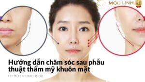 Huong-dan-cham-soc-sau-phau-thuat-tham-my-khuon-mat