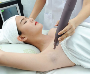 bai_viettri_tham_nach_bang_laser_loai_bo_vung_da_sam_mau_nhanh_chong_html_4_3e649b9cd1