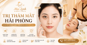 Avt thâm mắt