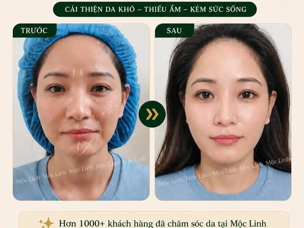 Tiêm BAP Uy Tín Hải Phòng