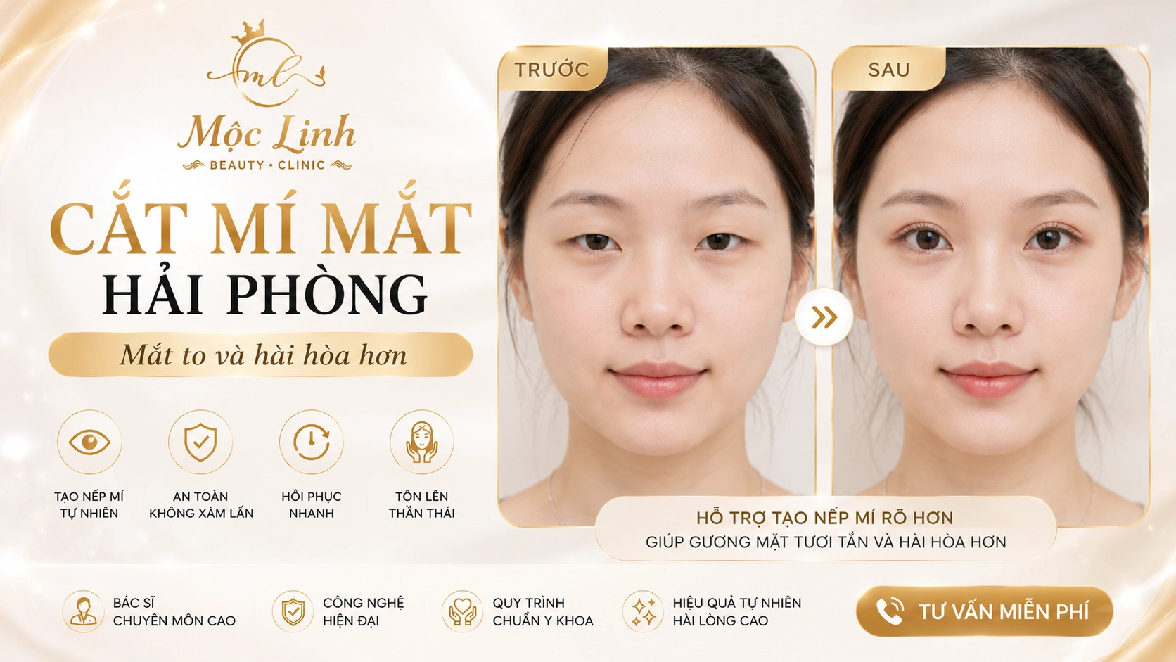 Cắt Mí
