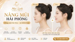Banner nâng mũi