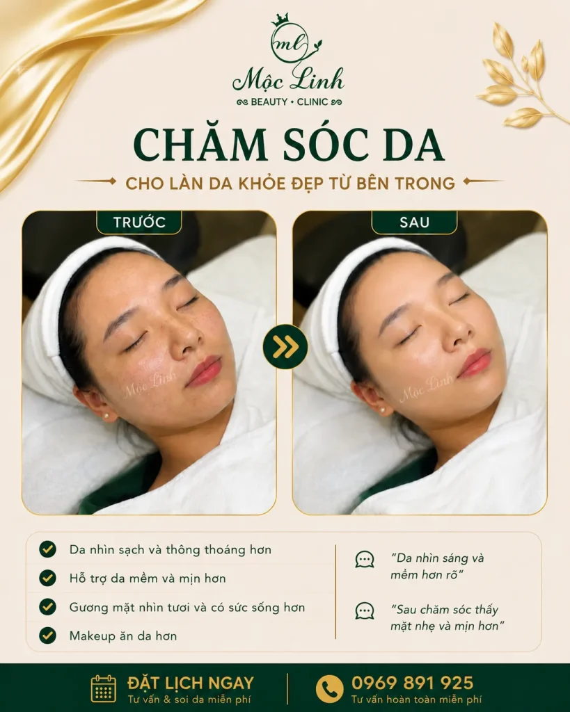 Chăm sóc da mặt Hải Phòng