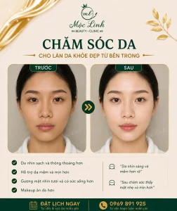 Chăm sóc da mặt Hải Phòng