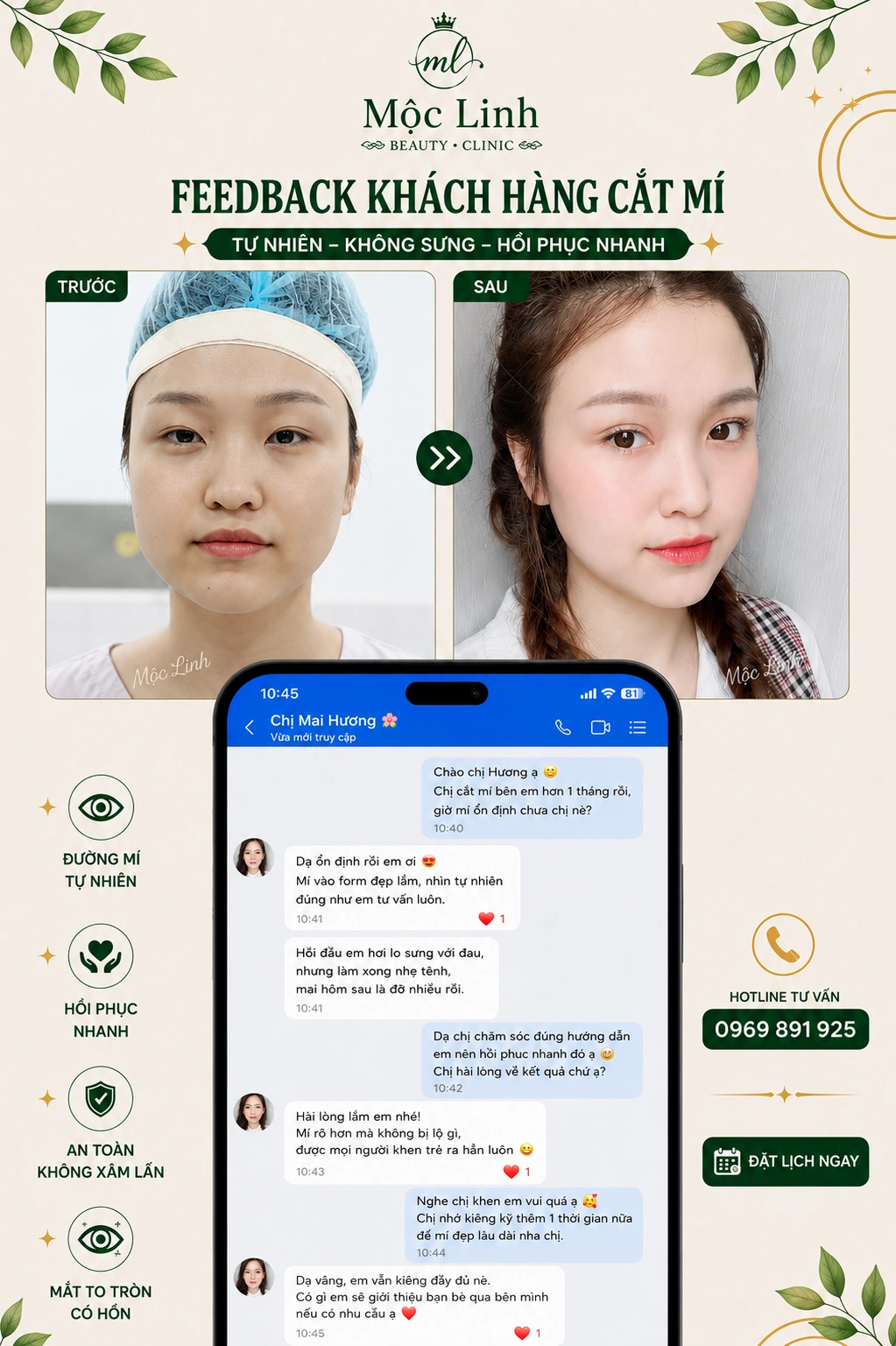 Dịch vụ cắt mí mắt Hàn Quốc tại Hải Phòng
